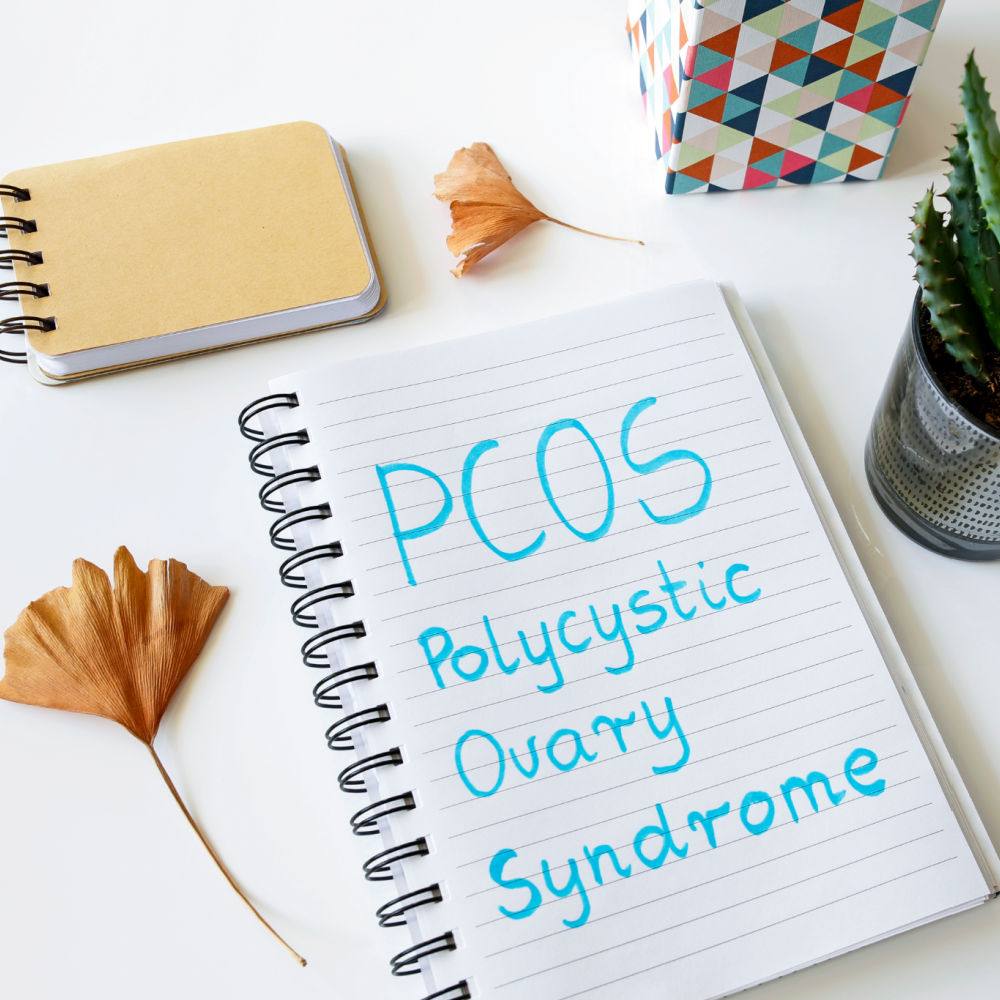 PCOS polycystisk ovarie syndrom