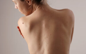 Smerter i ryggen kvinde følelser rygsmerter